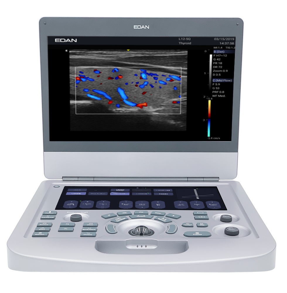 Acclarix AX3 Ultrasound Package